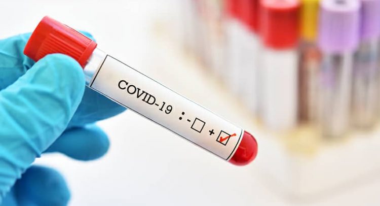 Covid19 Testing
