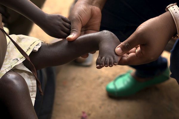 Kenya mothers'pressured to kill disabled babies'
